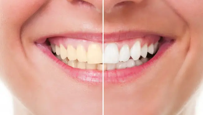 Reduce tooth staining